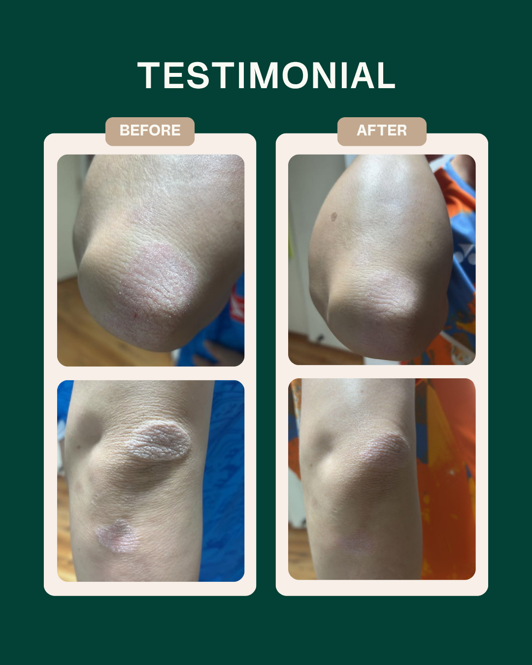 Ceramide Skin Repair Cream