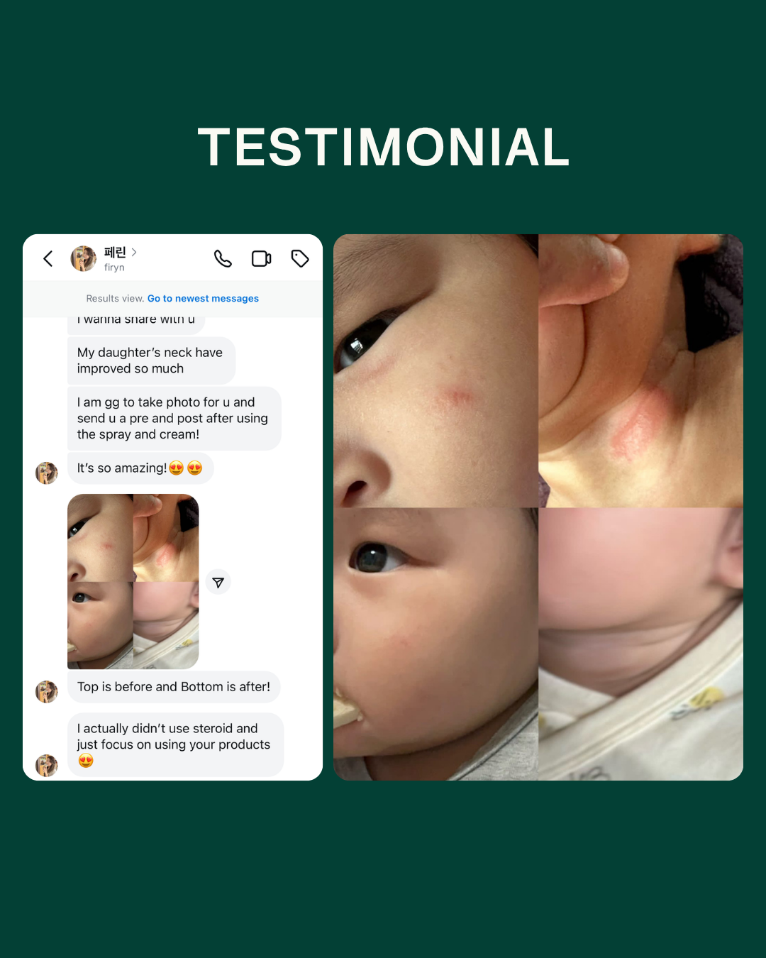 Ceramide Skin Repair Cream