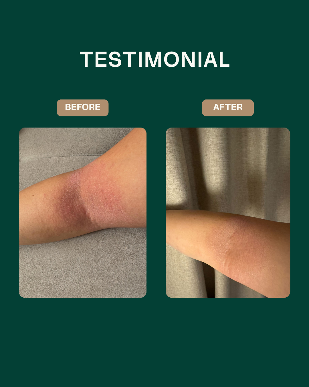 Ceramide Skin Repair Cream
