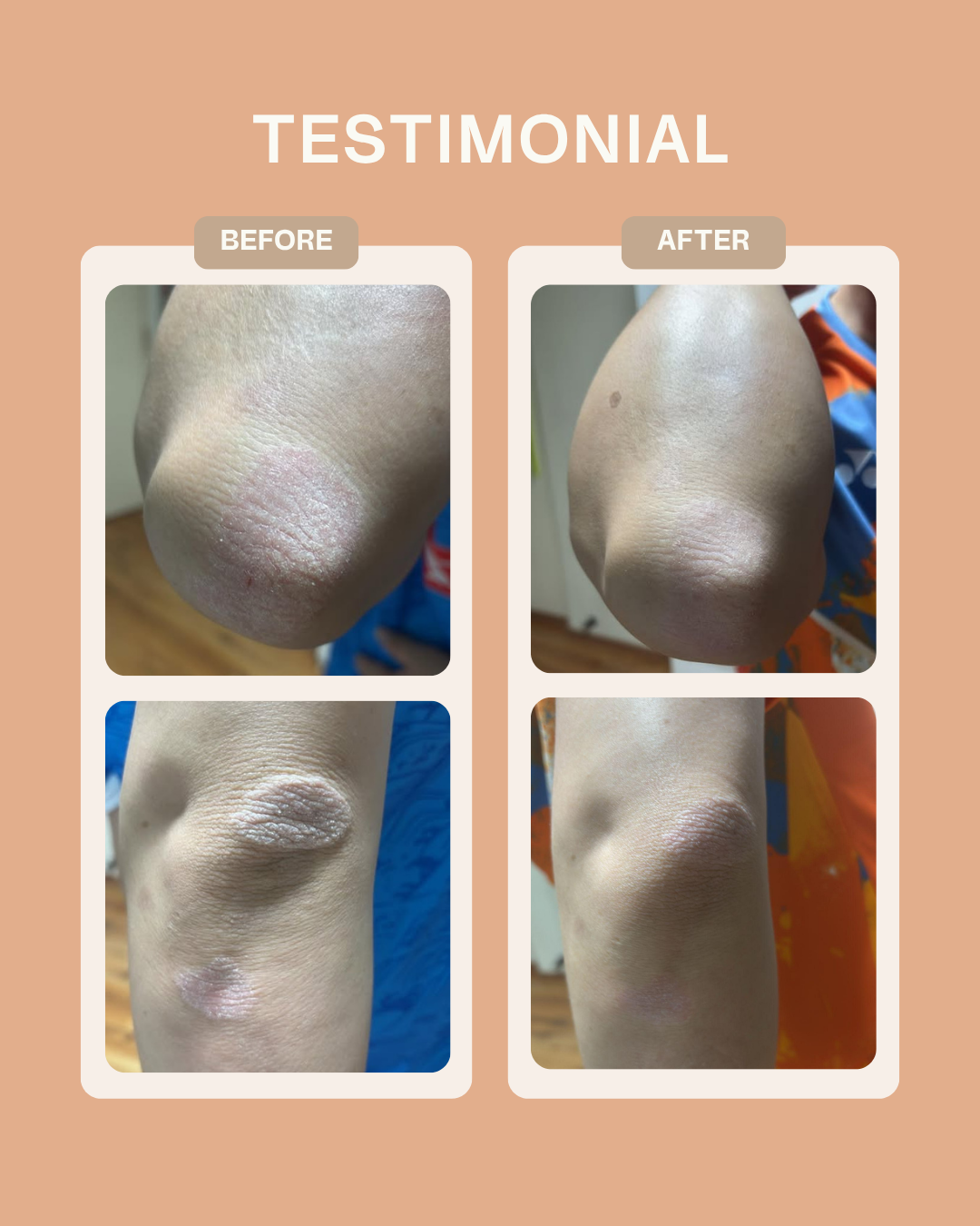 Ceramide Skin Repair Cream