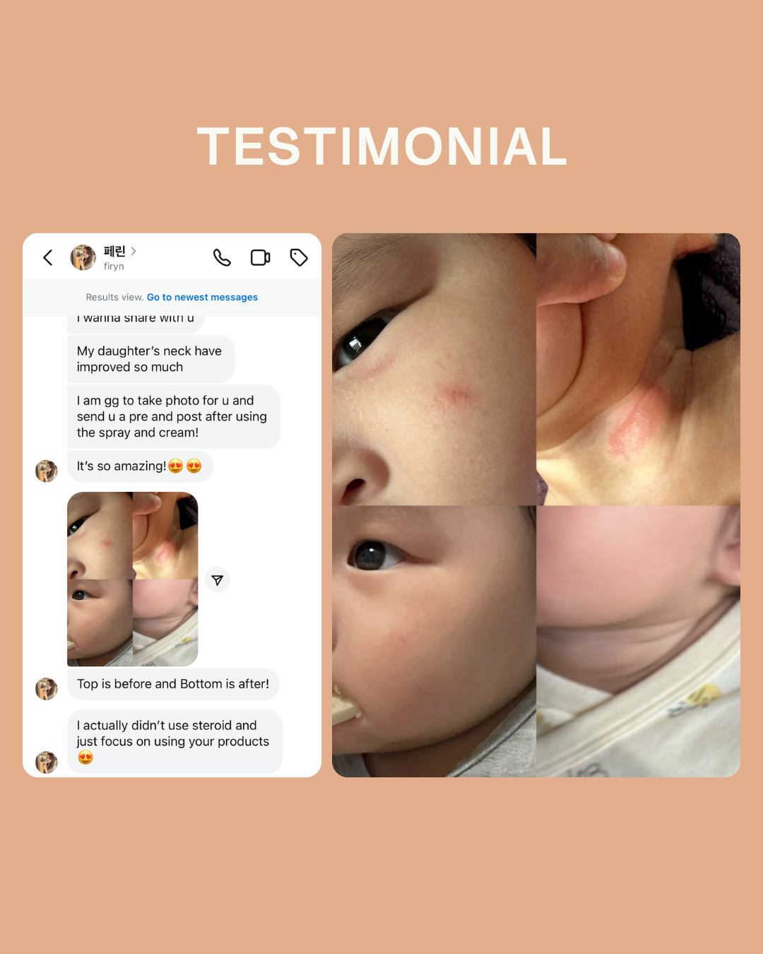 Ceramide Skin Repair Cream