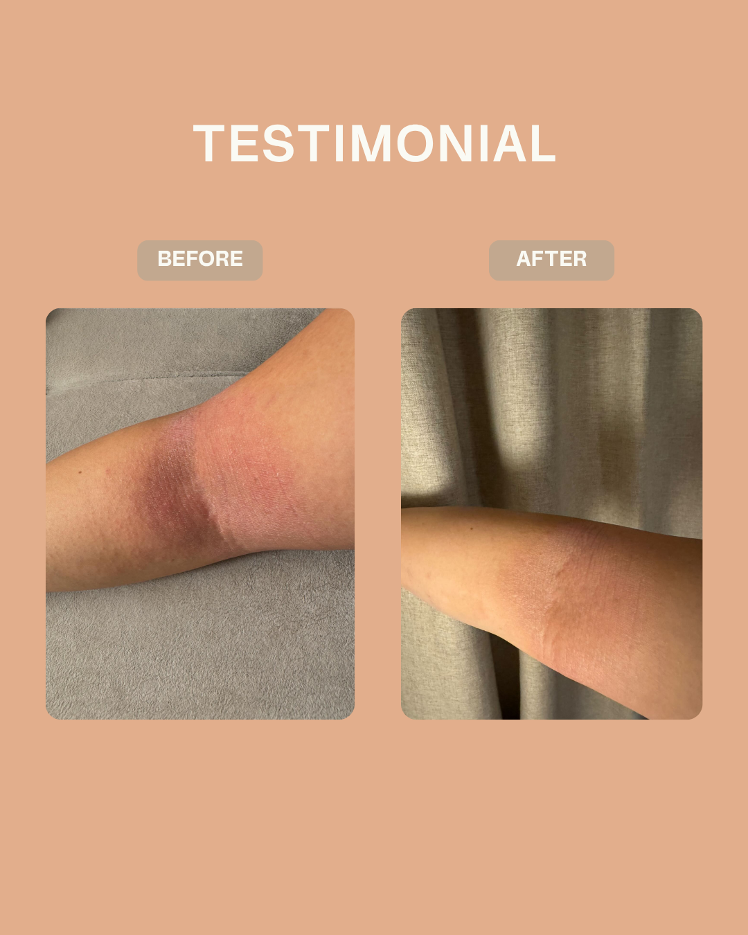 Ceramide Skin Repair Cream